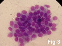cytology of anal sac tumor, photo by Dan Degner, DVM