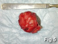 anal sac tumor being removed, photo by Dan Degner, DVM