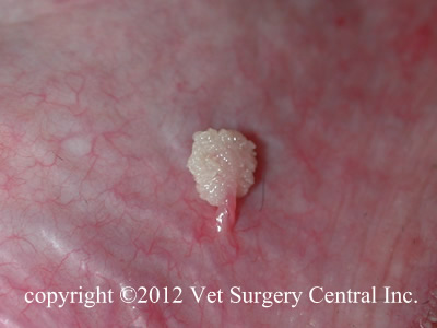 mouth papilloma removal
